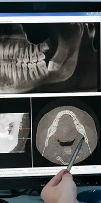 Tracing Software Orthodontie