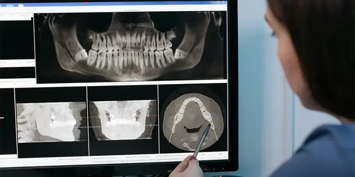 Tracing Software Orthodontie